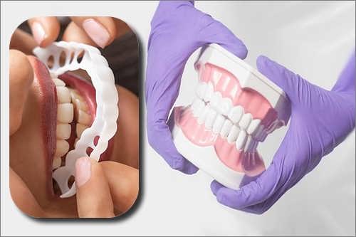 ایا لمینت متحرک دندان برای همه فک ها مناسب است :