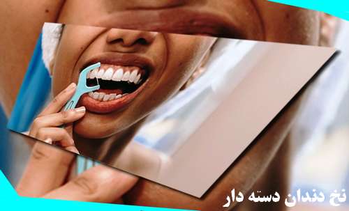 فواید و مزیت استفاده از نخ دندان چیست (نخ دندان مخصوص لمینت)