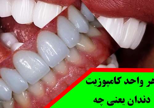 هر واحد کامپوزیت دندان یعنی چه