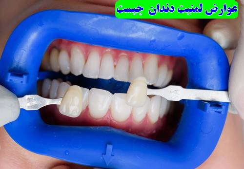 عوارض لمنیت دندان چیست