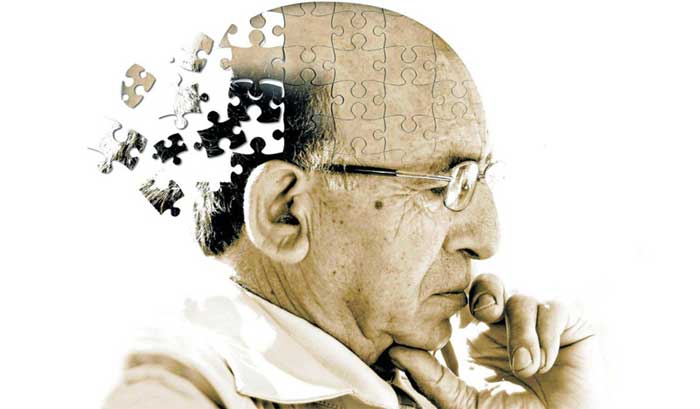 تفاوت آلزایمر و زوال عقل چیست؟
